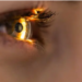 laser eye surgery