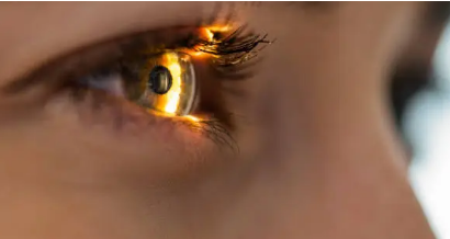 laser eye surgery